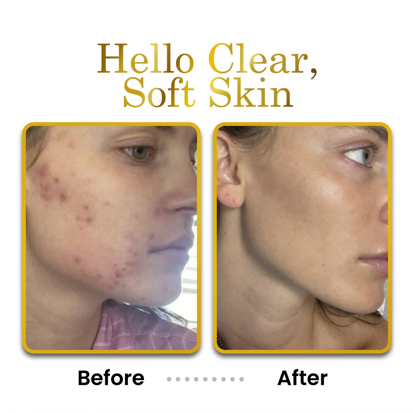 Face, Neck & Hand Moisturizer - 8.5 oz Unscented
